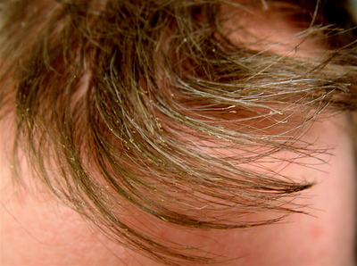ryan-new-hair.jpg